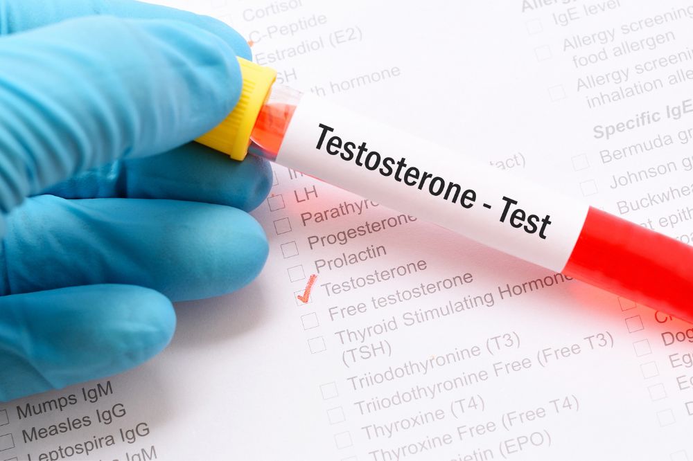 Testosterone Therapy